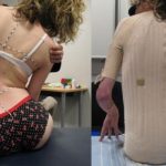 Postural Splint - Image 2