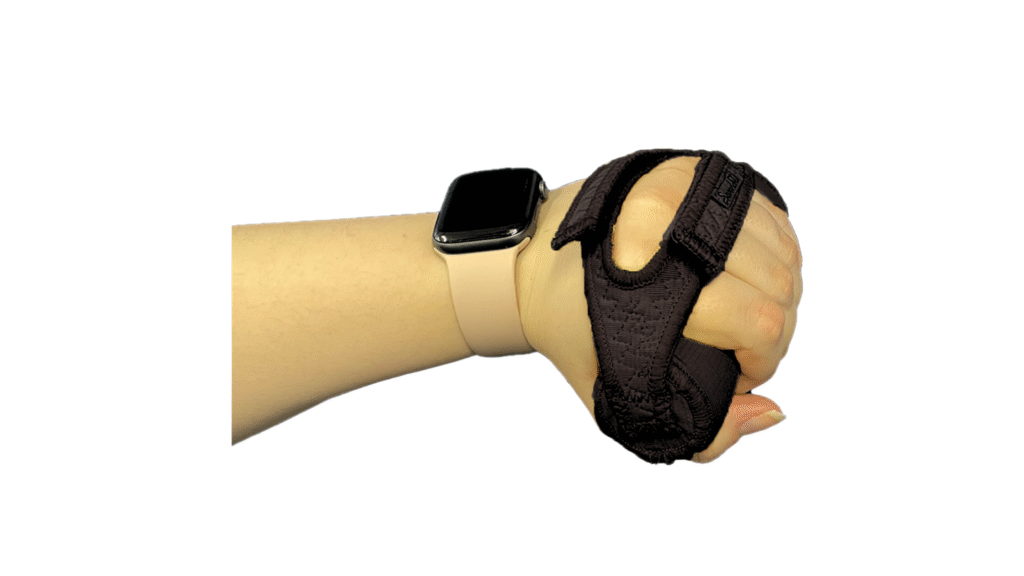 3 Palmar Hand Cone 1