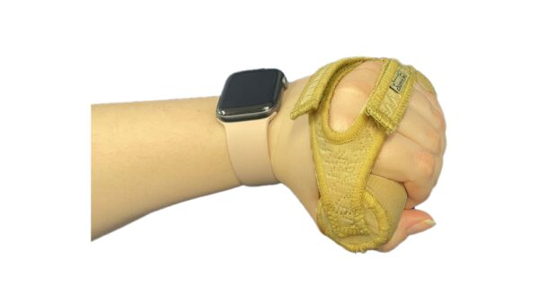 Palmar Hand Cone - Image 2